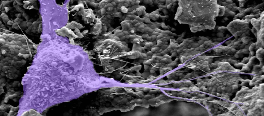 Bone cell on biomaterial surface
