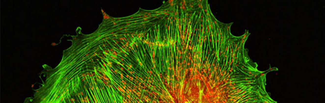 Confocal image of actin cytoskeleton