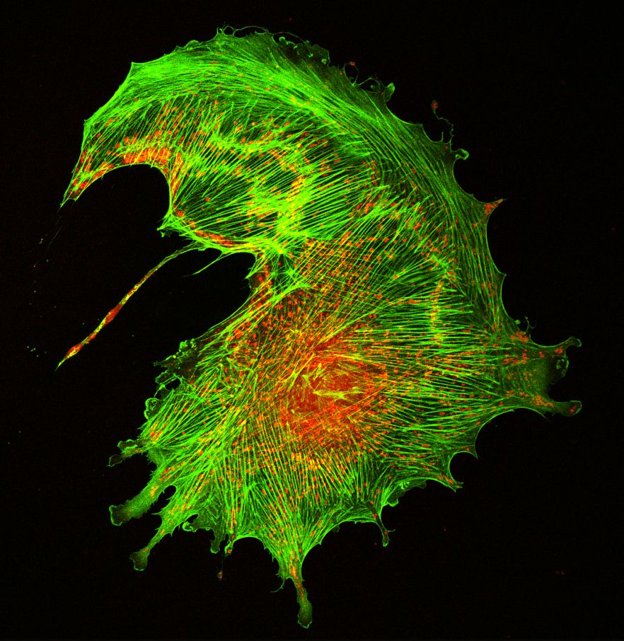 Confocal image of cytoskeleton