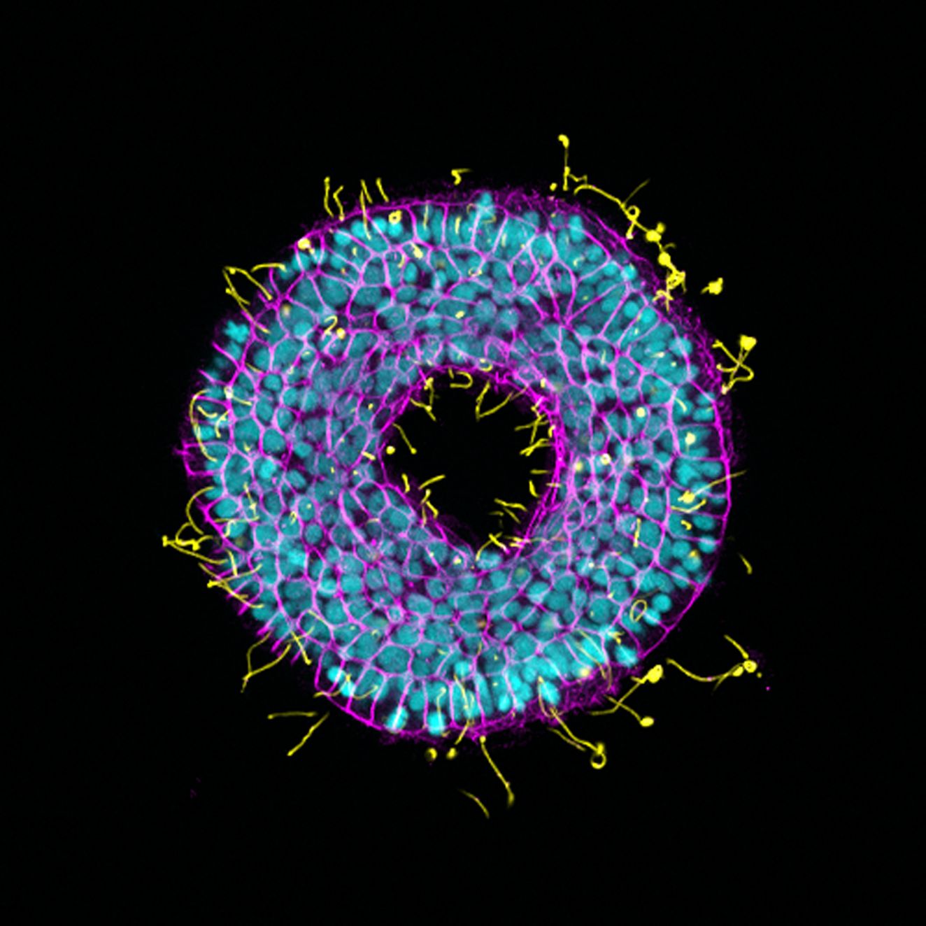 Gastrula of Oweinia fusiformis (Image credit: Allan Carrillo)