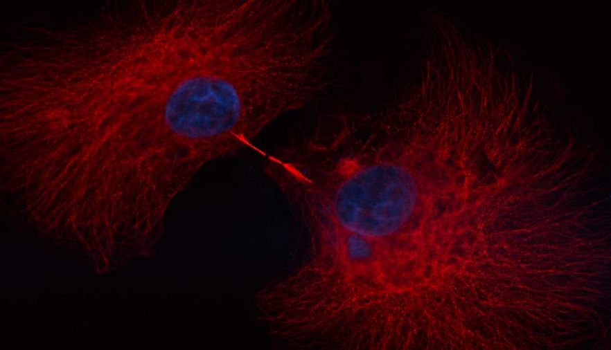 ageing fibroblasts