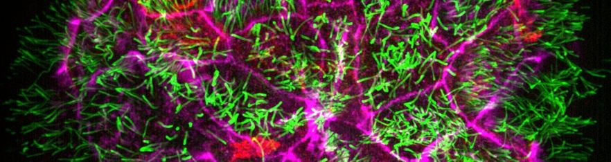 Multiscale Imaging
